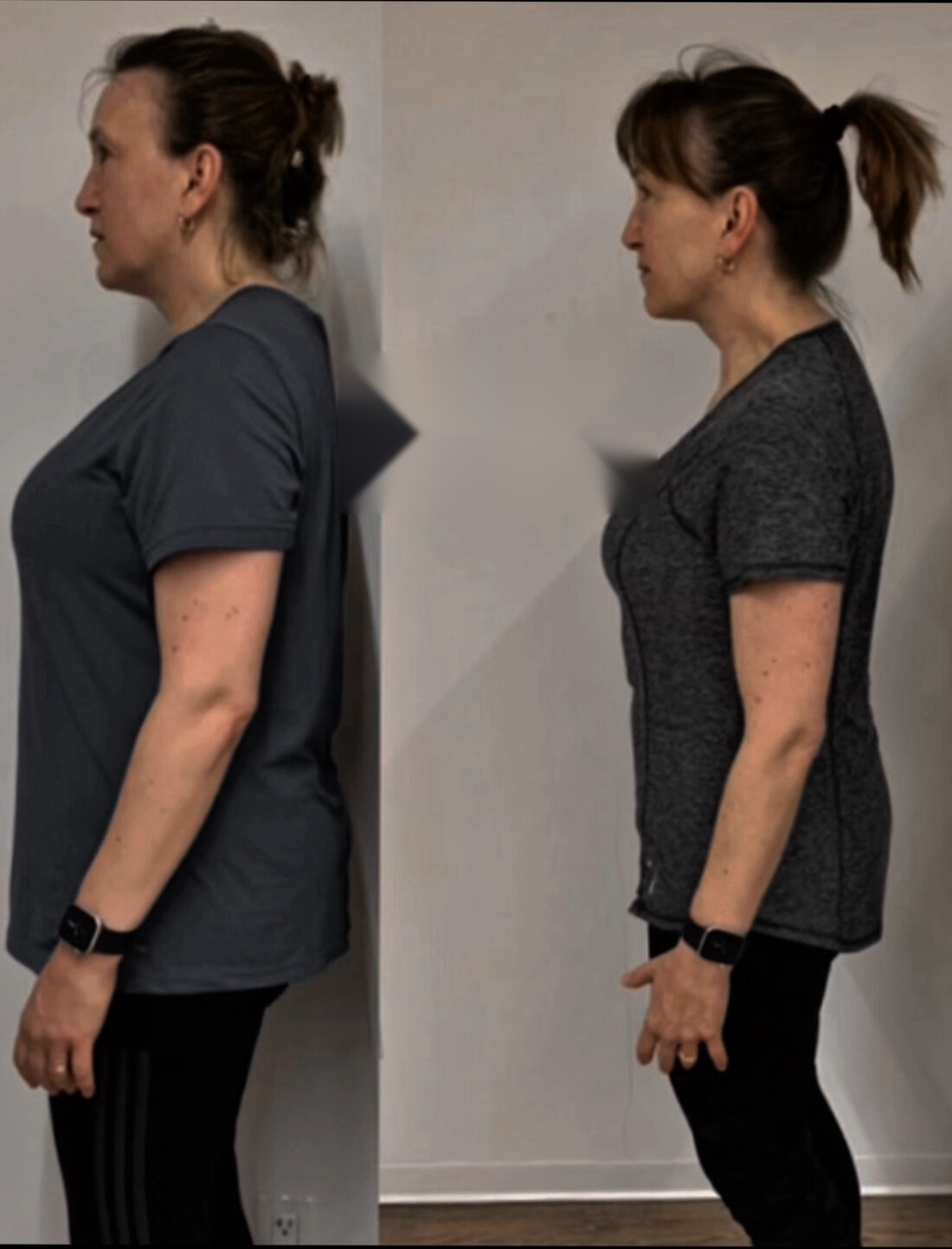 Client body transformation, before and after