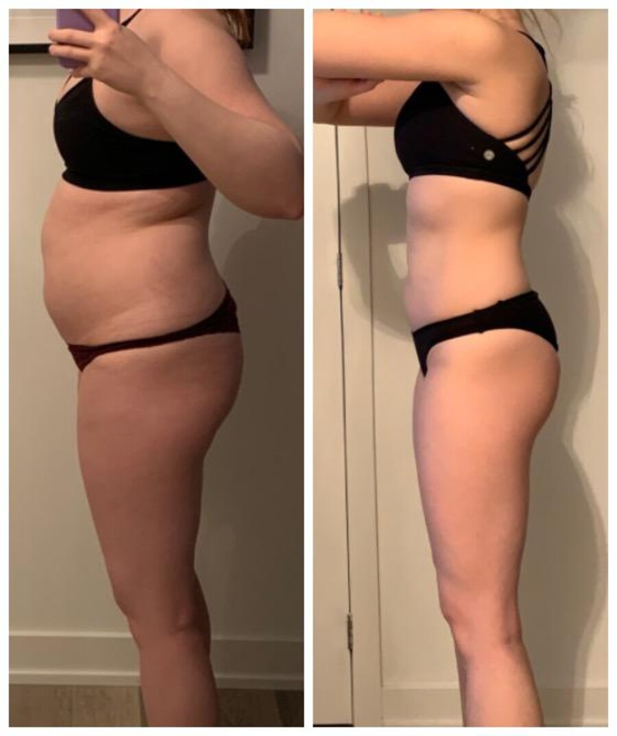 Client body transformation, before and after